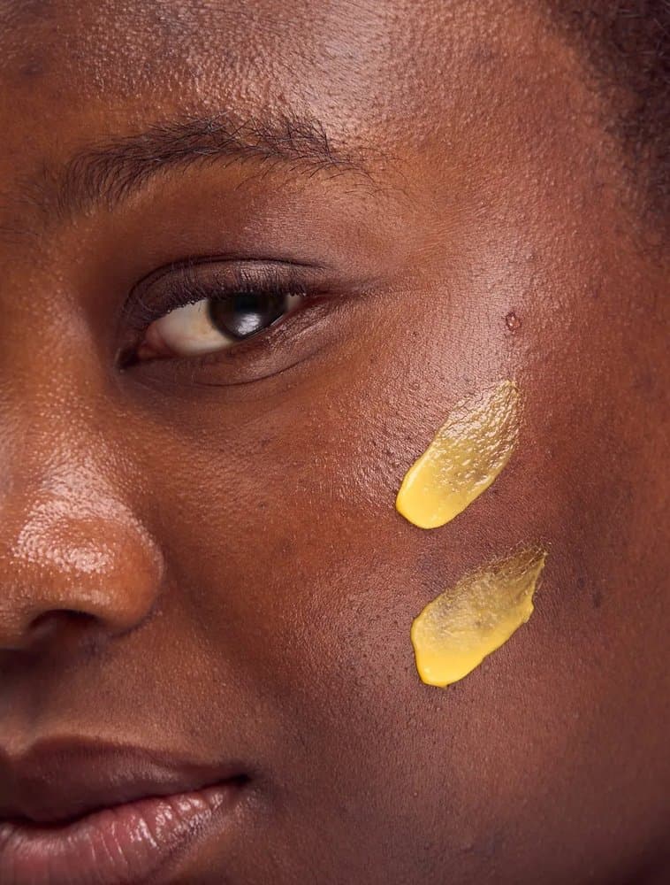 Gros plan sur deux touches de crème jaune au curcuma appliquées sur la joue, montrant leur texture onctueuse et ciblée.