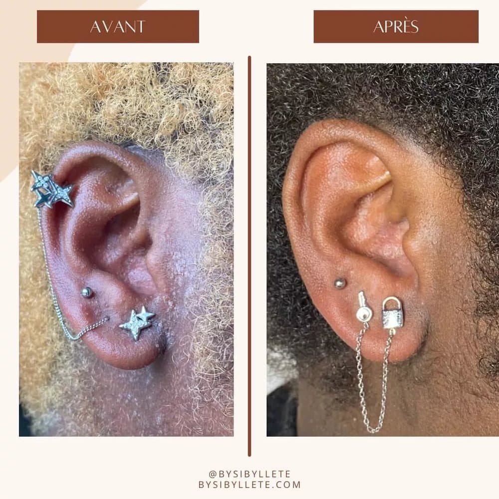 Comparatif avant et après montrant l'apaisement et la régénération de la peau desséchée sur la zone de l'oreille.